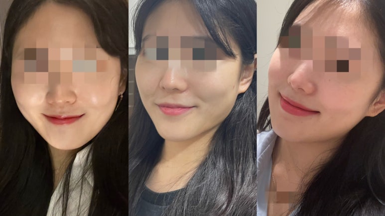 오직얼굴연구소 이미지