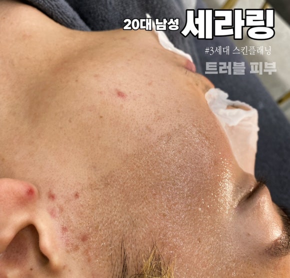 네일세라 이미지