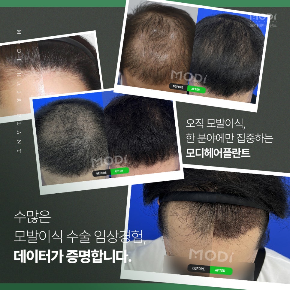 모디헤어 이미지
