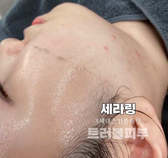 네일세라 이미지