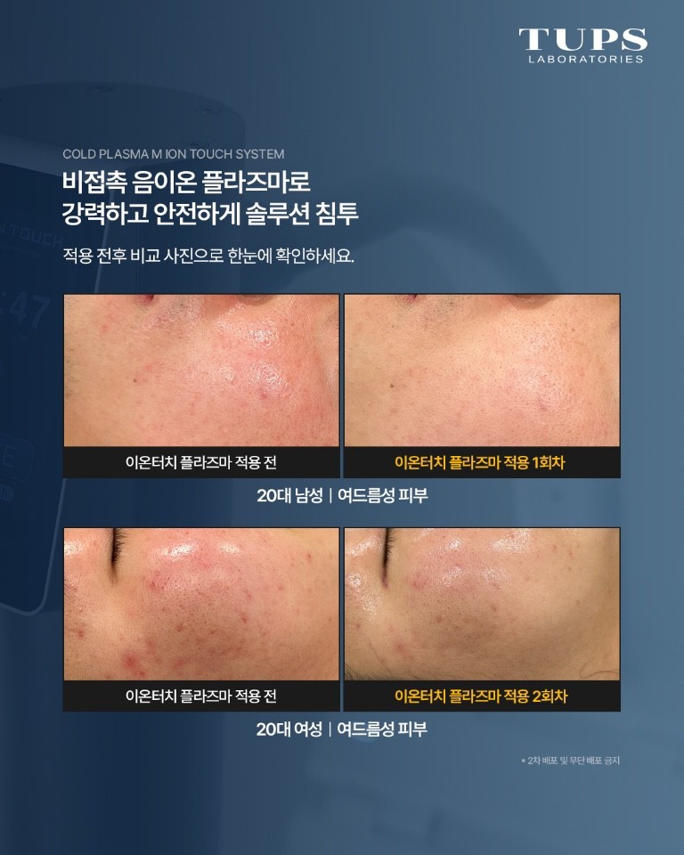 터치피부샵 이미지