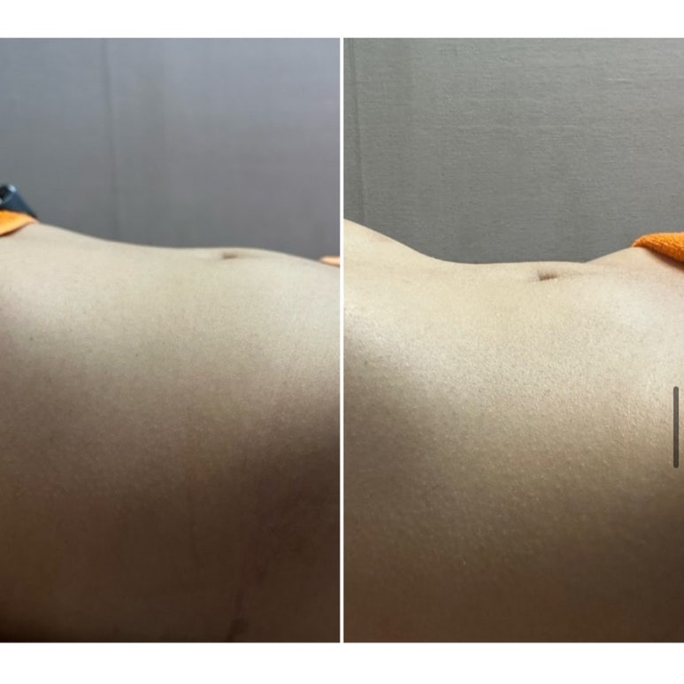 귀족뷰티(피부관리실) 이미지