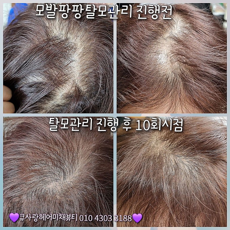 큐사랑미채뷰티 이미지