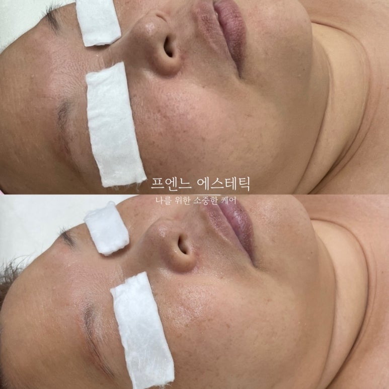 프엔느에스테틱 이미지