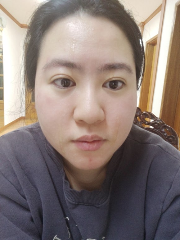 레드벨플라워 이미지