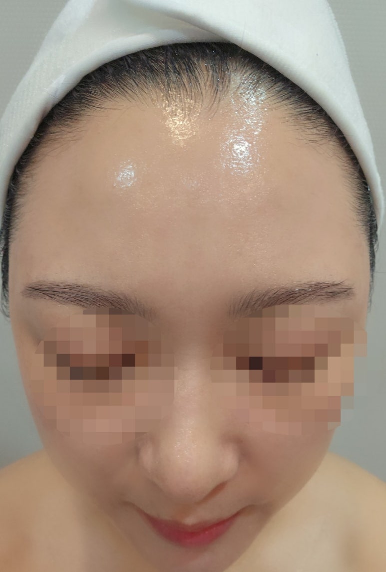 이새뷰티 주름마법사 이미지