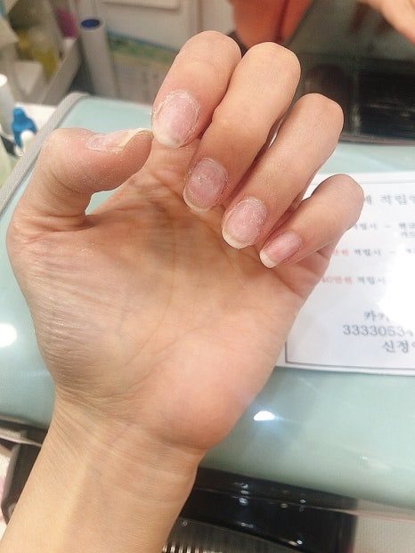 네일온제 이미지