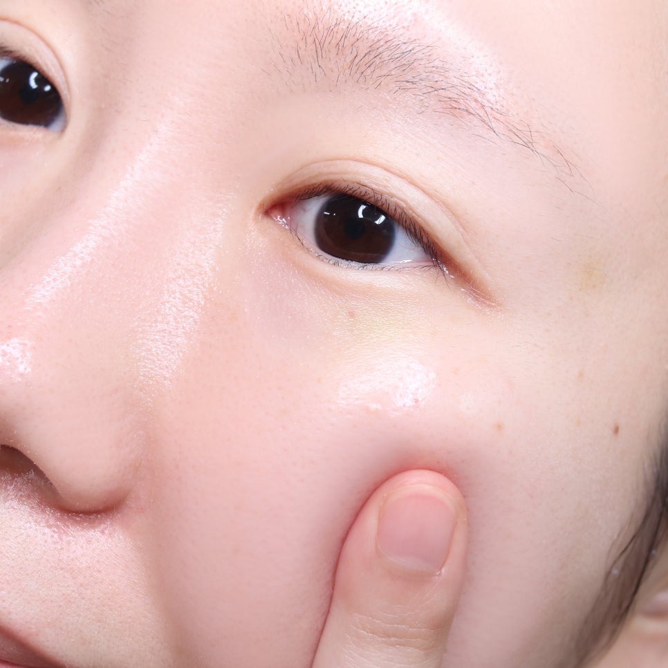블루테라피에스테틱 이미지