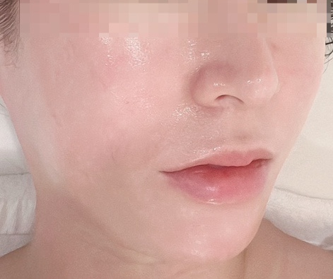 유니나 피부관리 이미지