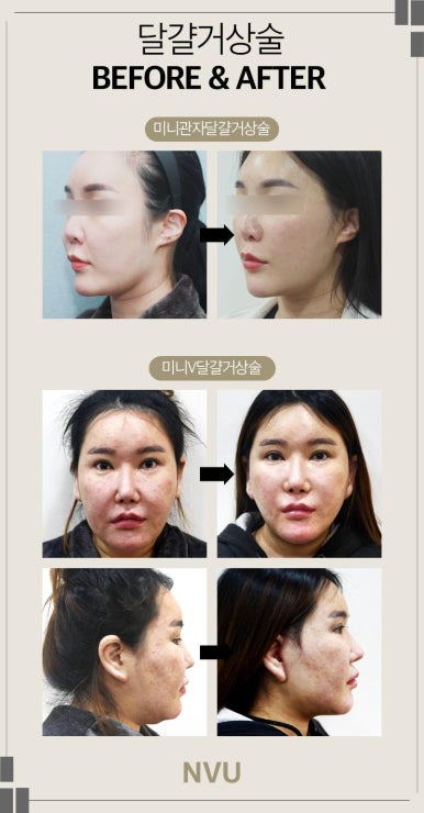 엔비유의원 이미지