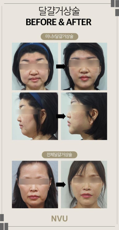 엔비유의원 이미지