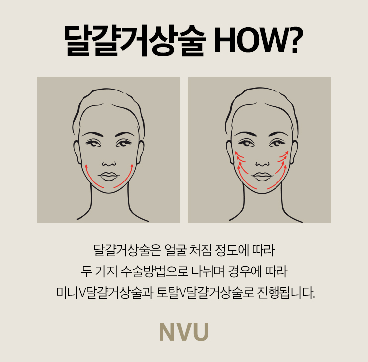 엔비유의원 이미지