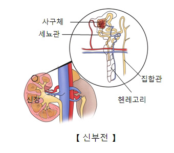 만성설비 이미지