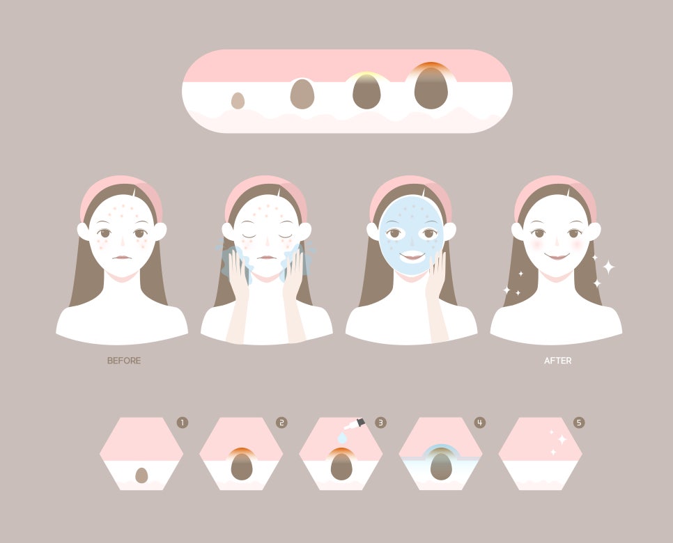 새로이피부 이미지