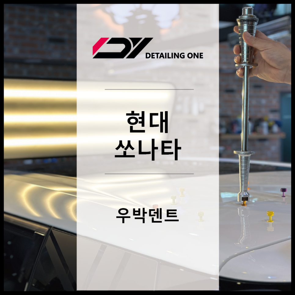 우박덴트원중랑 이미지