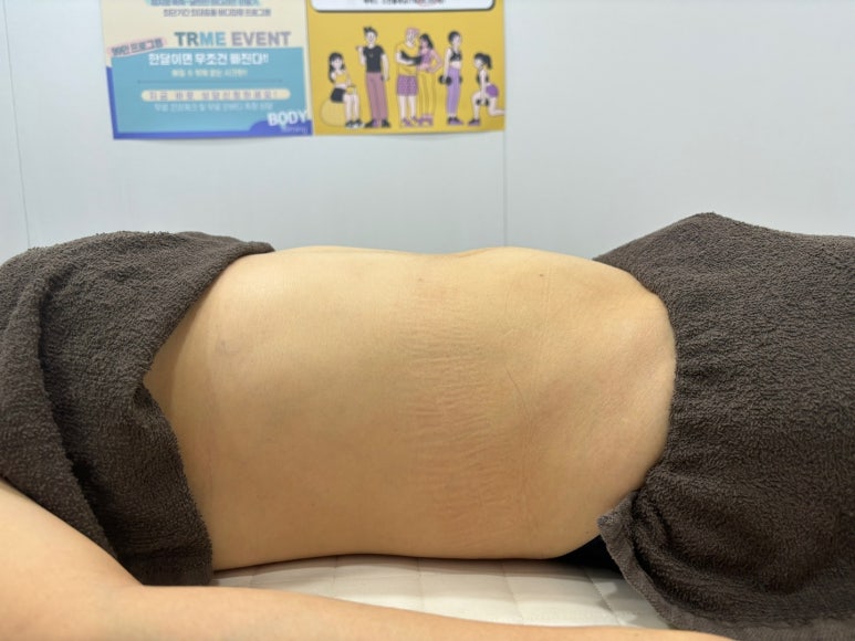 임뷰티 이미지