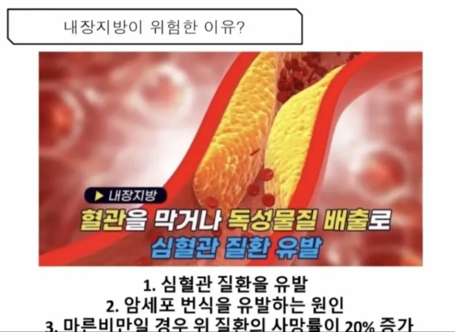 참쉬운다이어트 이미지