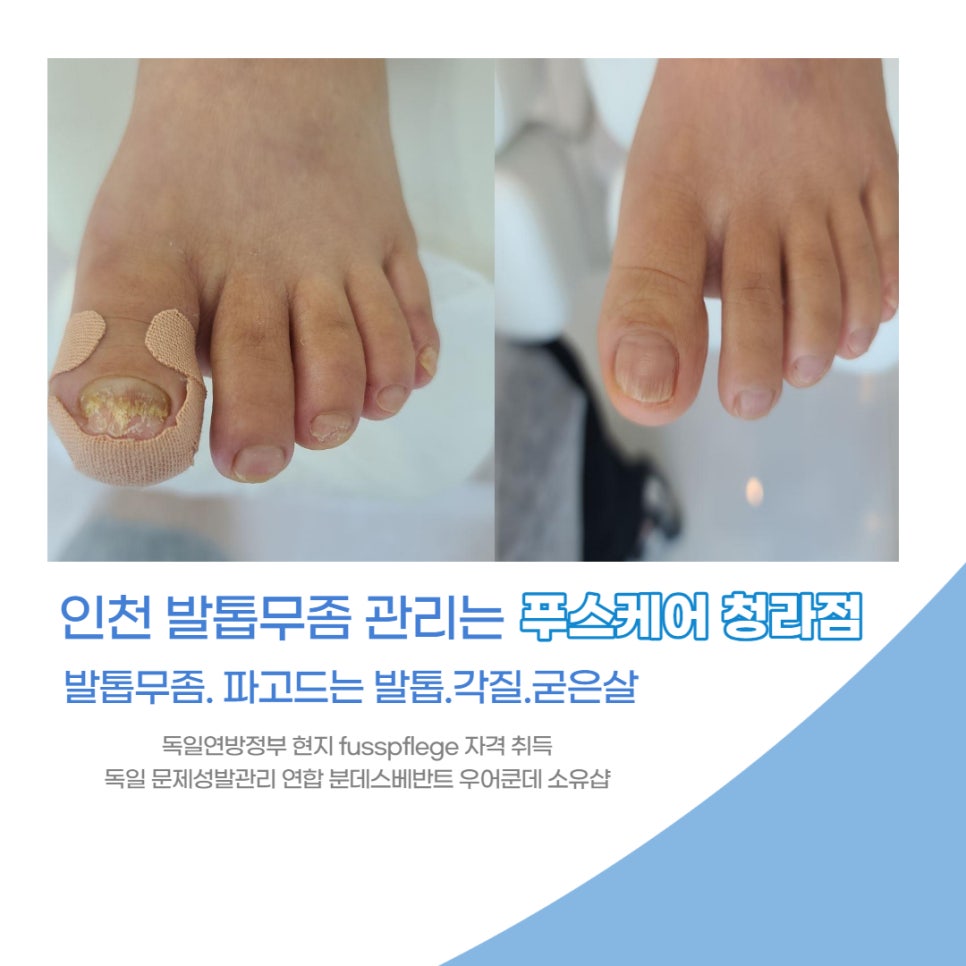 푸스케어 청라점 이미지