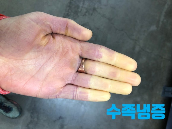 수족발 이미지