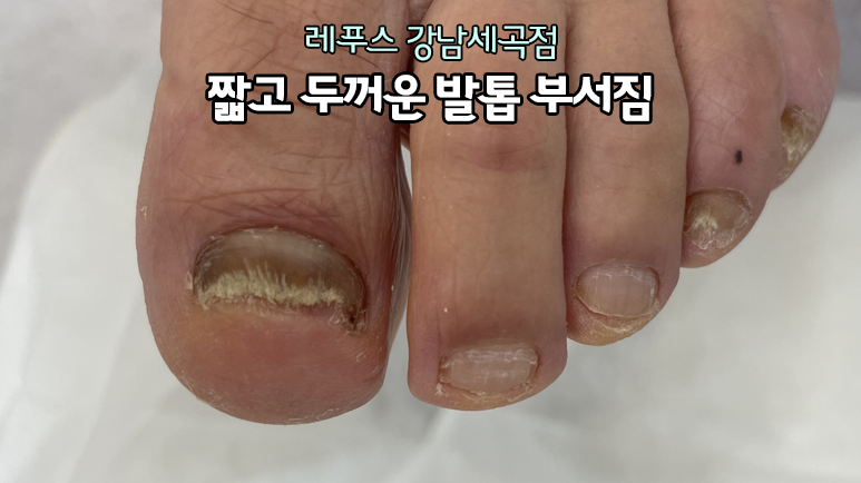 레푸스강남세곡점 이미지