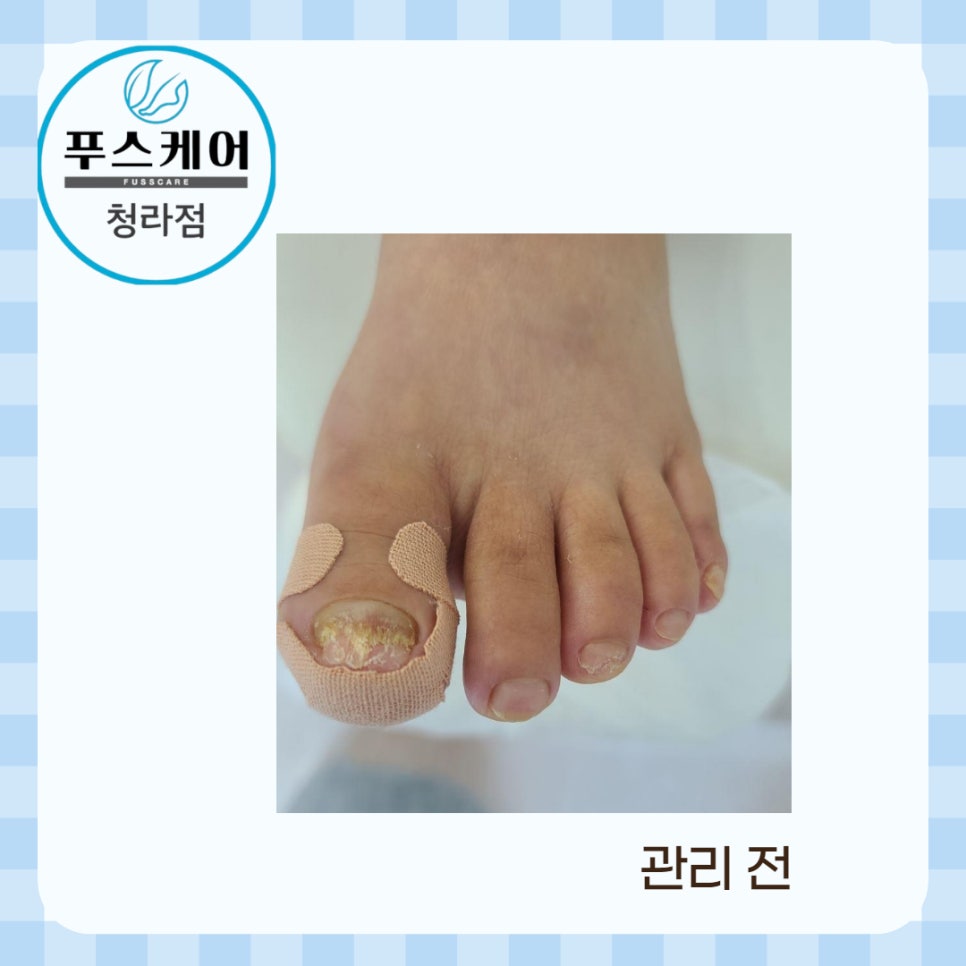 푸스케어 청라점 이미지