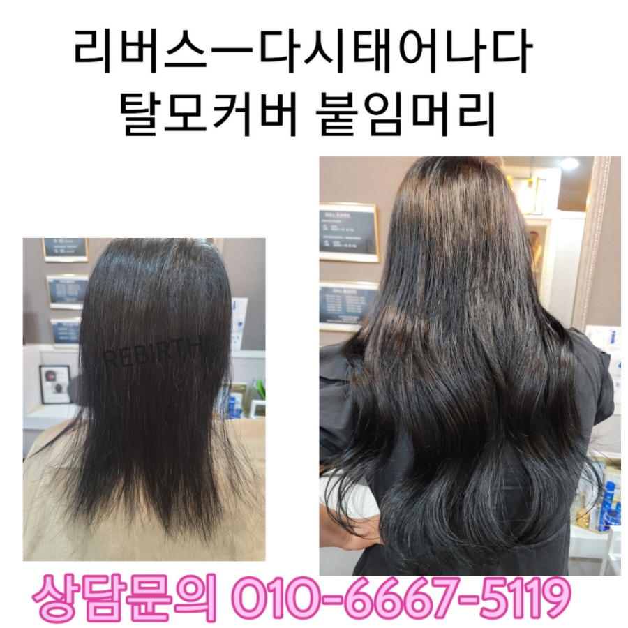탈모응급실 리버스-다시태어나다 이미지