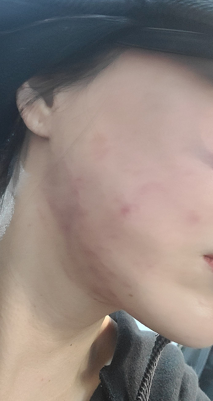 미미썸의원 이미지