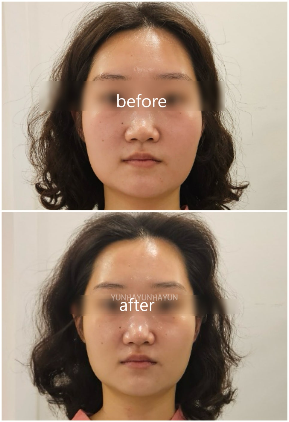 허치벨 이미지