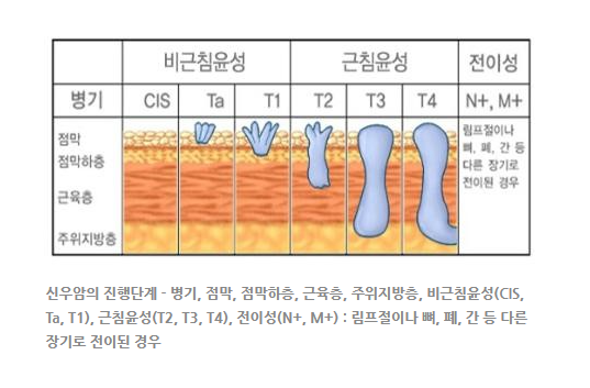 신우광고 이미지
