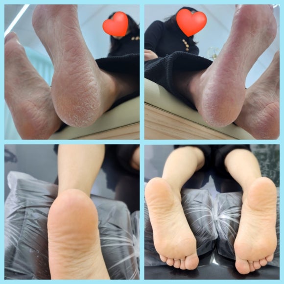 깐네일 이미지