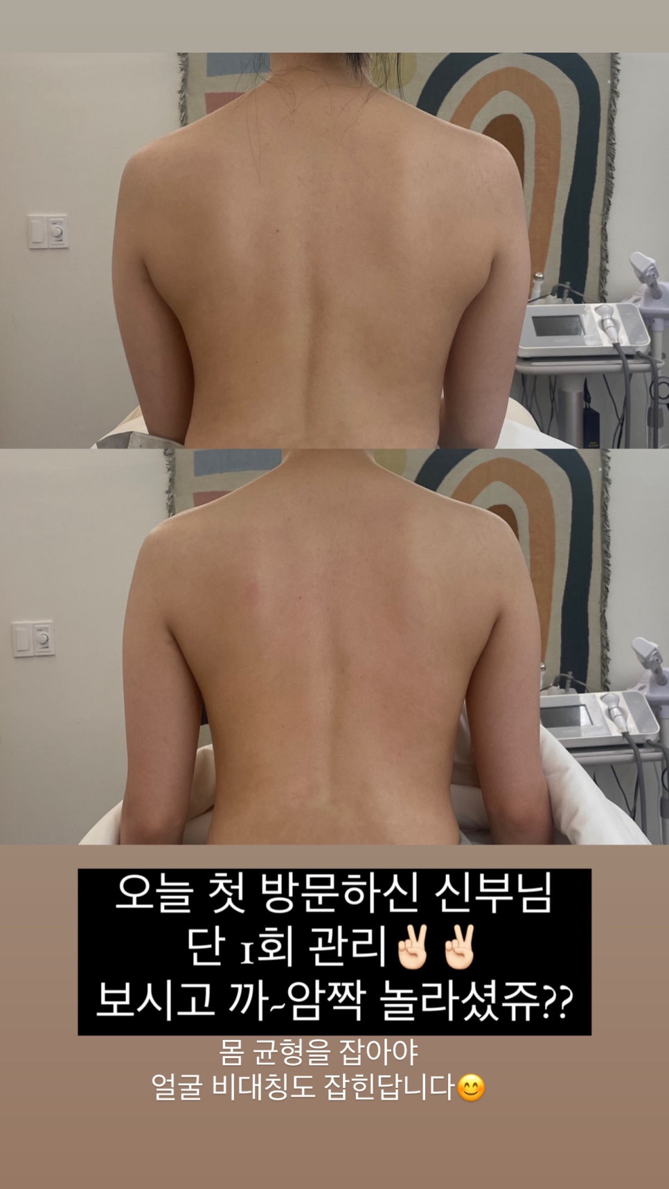 전에스테틱 이미지