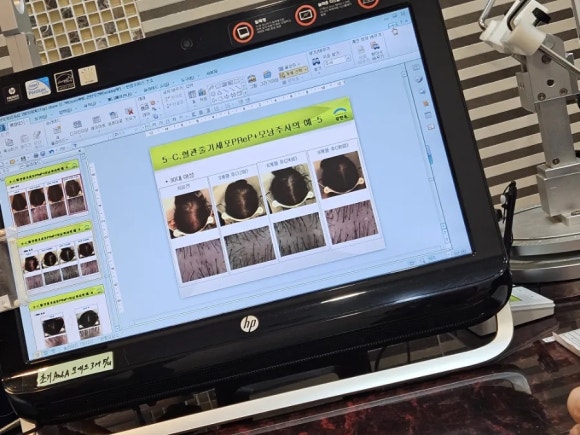 세브란스피부과의원 이미지