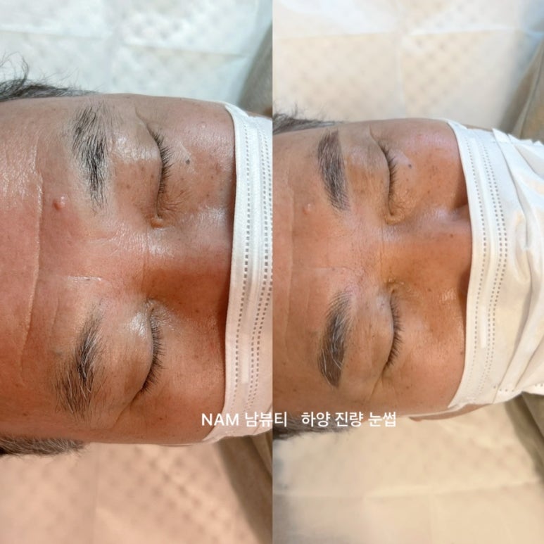 눈썹더하기 이미지