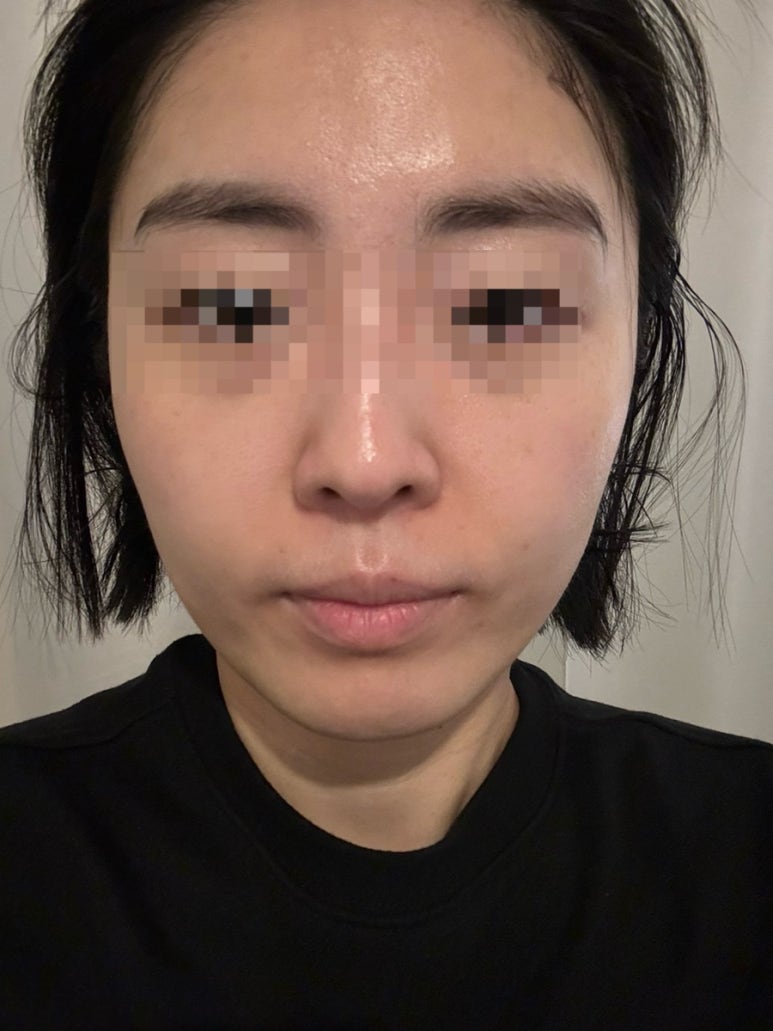 나피부샾 이미지