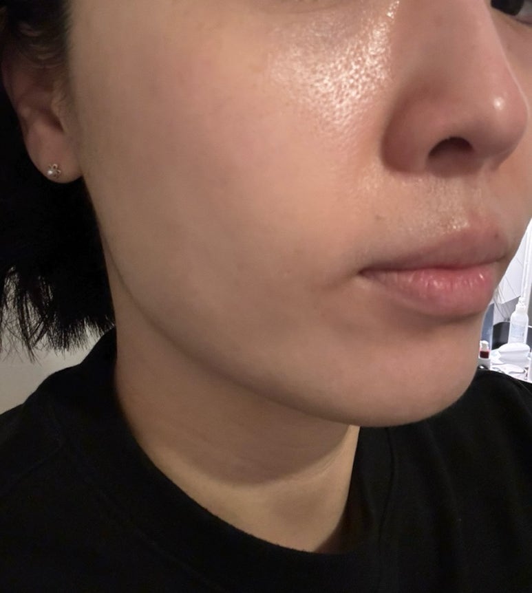 나피부샾 이미지