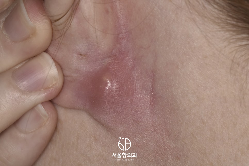 서울항외과 이미지