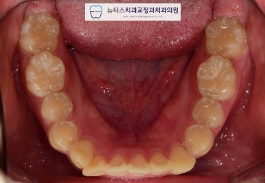 뉴티스치과교정과치과의원 이미지