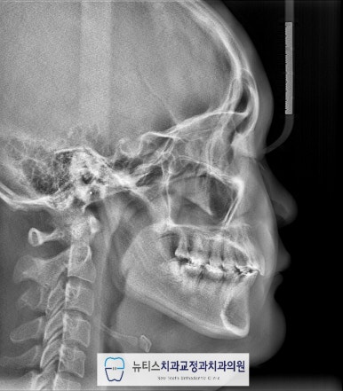 뉴티스치과교정과치과의원 이미지