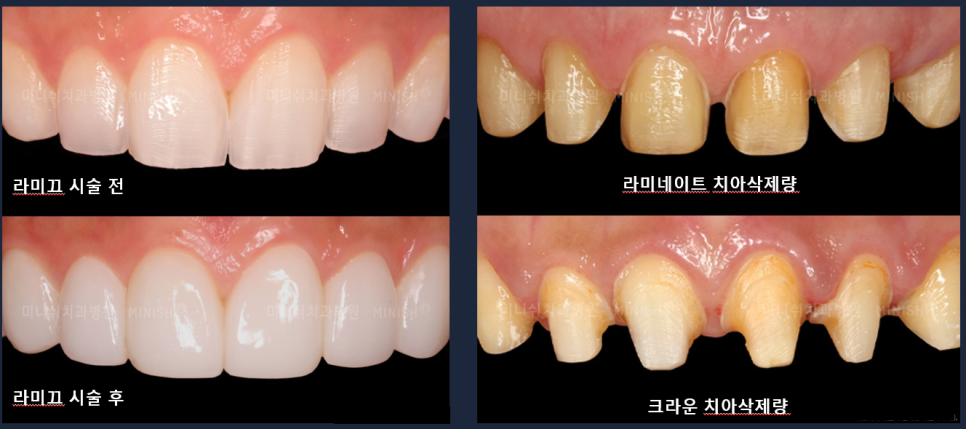 라미끄 이미지