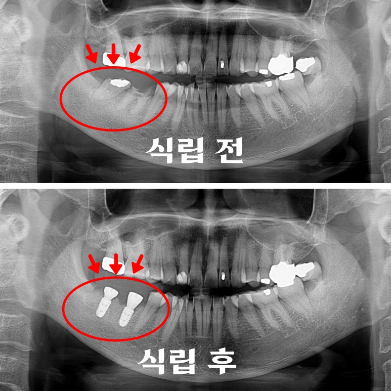남양스타치과 이미지