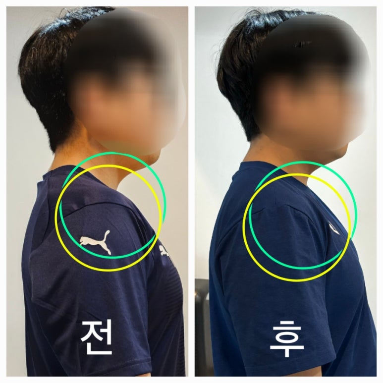 웨스트짐 이미지