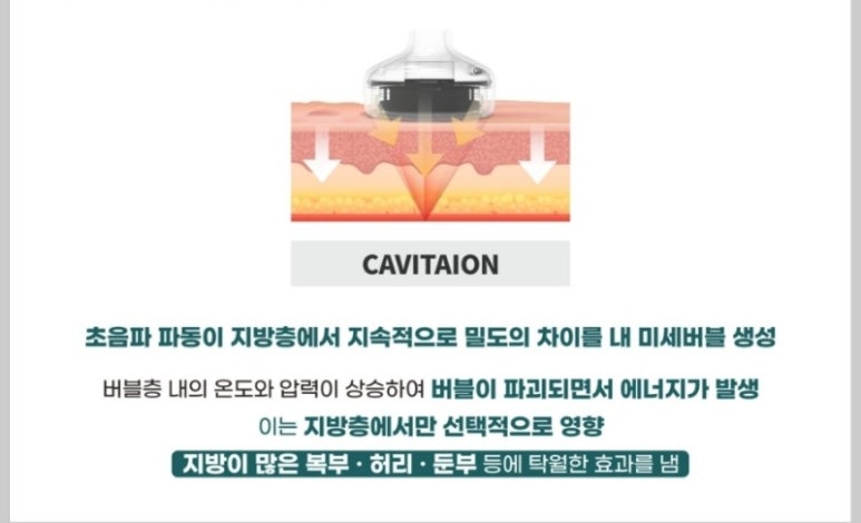 리셀라인 이미지