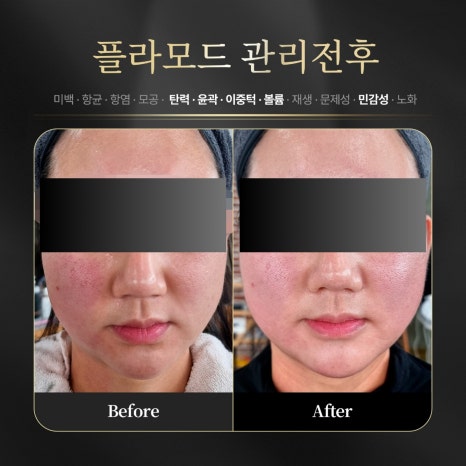 로로코스메틱 이미지