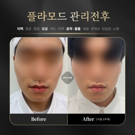 로로코스메틱 이미지