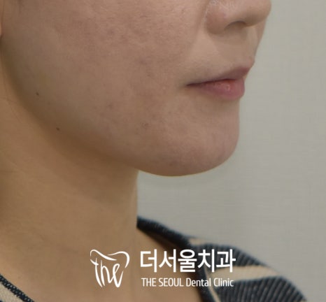 화창정밀 이미지