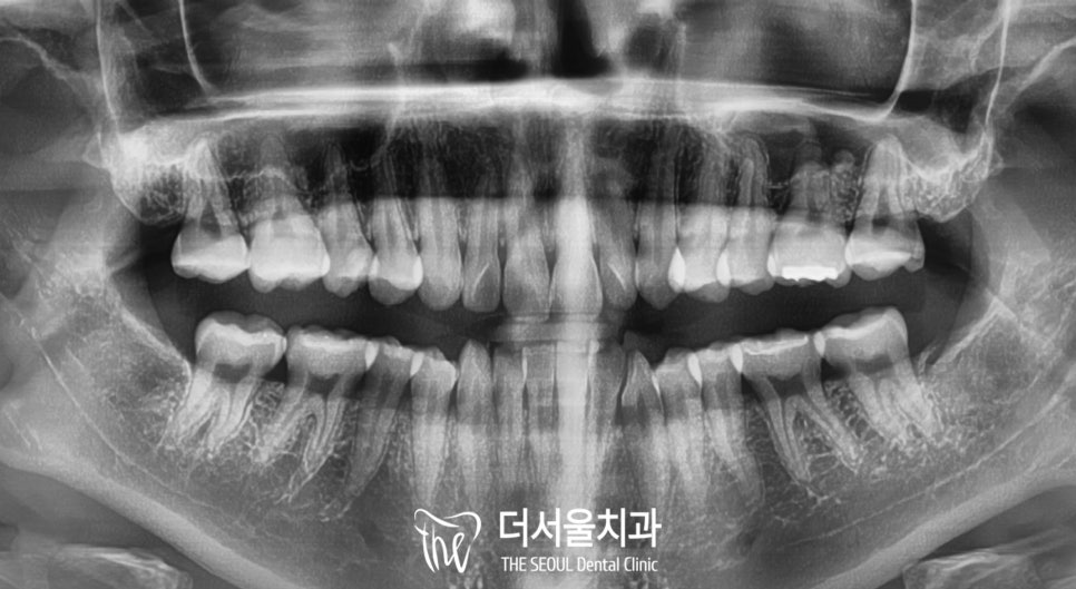 화창정밀 이미지