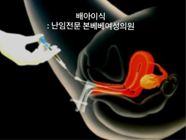 본베베여성의원 이미지
