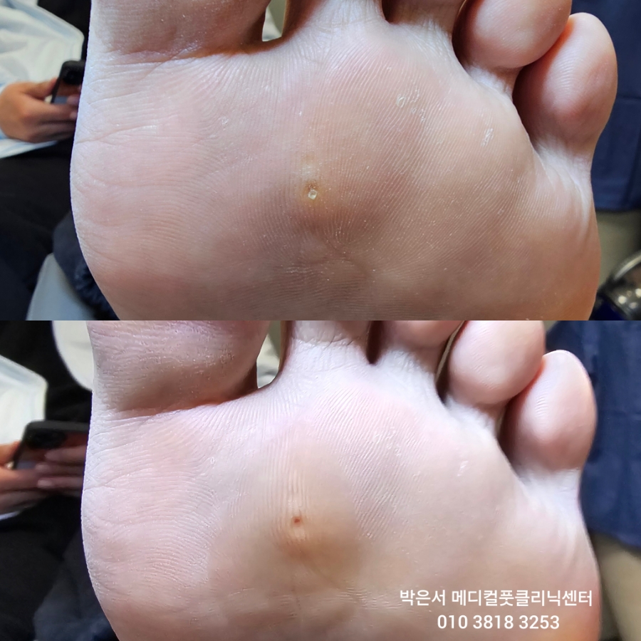 박은서메디컬풋클리닉센터 이미지