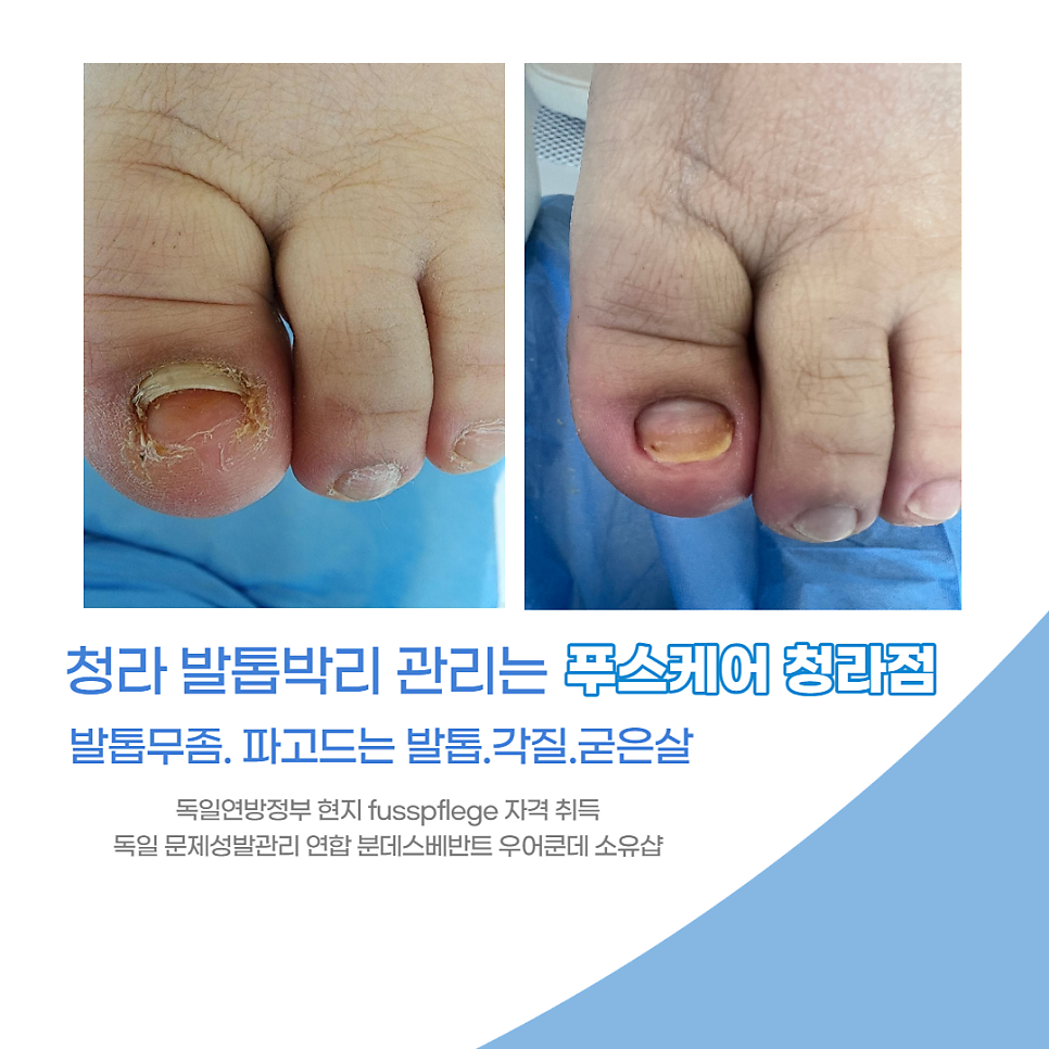 푸스케어 청라점 이미지