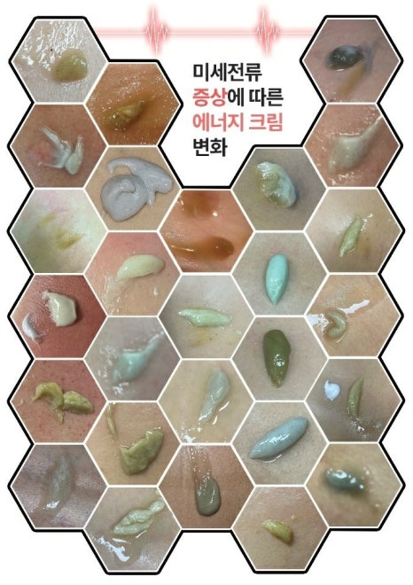 미테라피 이미지